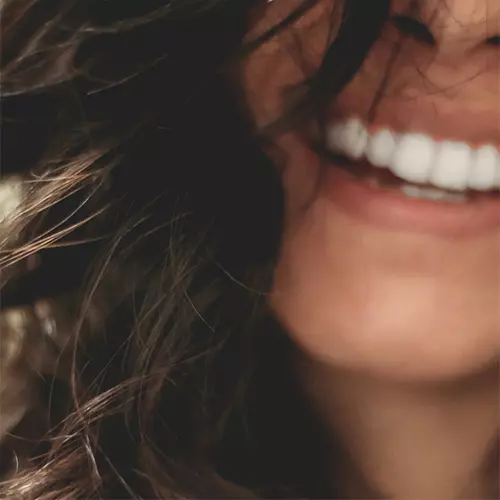 Woman Smiling with Porcelain Veneers