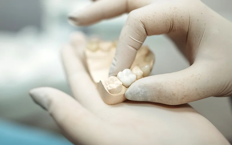 Dentist Holding Dental Crown & Molding